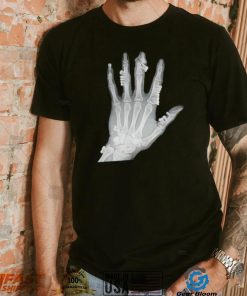 Eduardo Valdes Hevia hand teeth Xray shirt