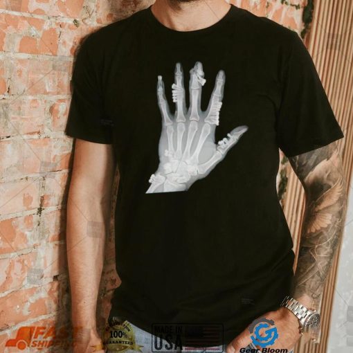 Eduardo Valdes Hevia hand teeth Xray shirt