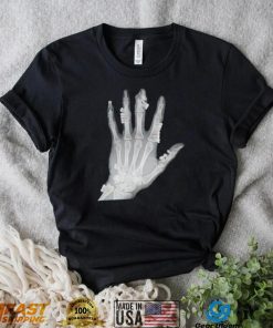 Eduardo Valdes Hevia hand teeth Xray shirt