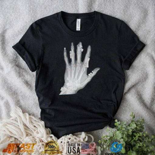 Eduardo Valdes Hevia hand teeth Xray shirt