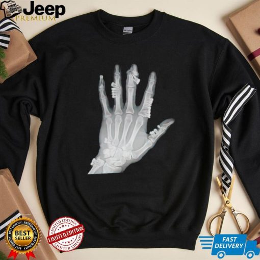 Eduardo Valdes Hevia hand teeth Xray shirt