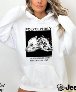 Polycephaly the condition of having more than one head shirt